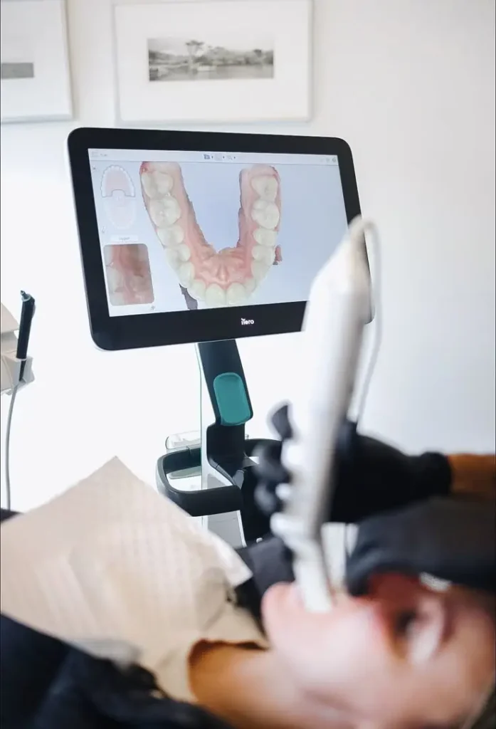 DIGITAL-SCANNING_-A-new-dawn-for-your-dental-experience_-At-Adawn_-we-use-cutting-edge-technology-to (1)