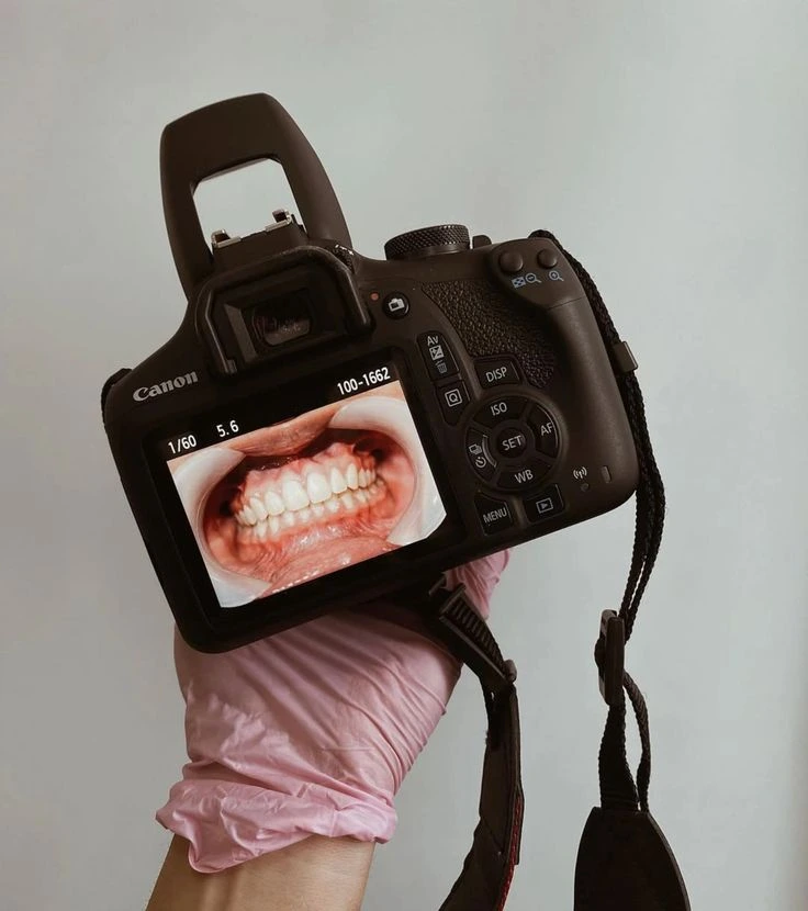 Dental Photography 🦷