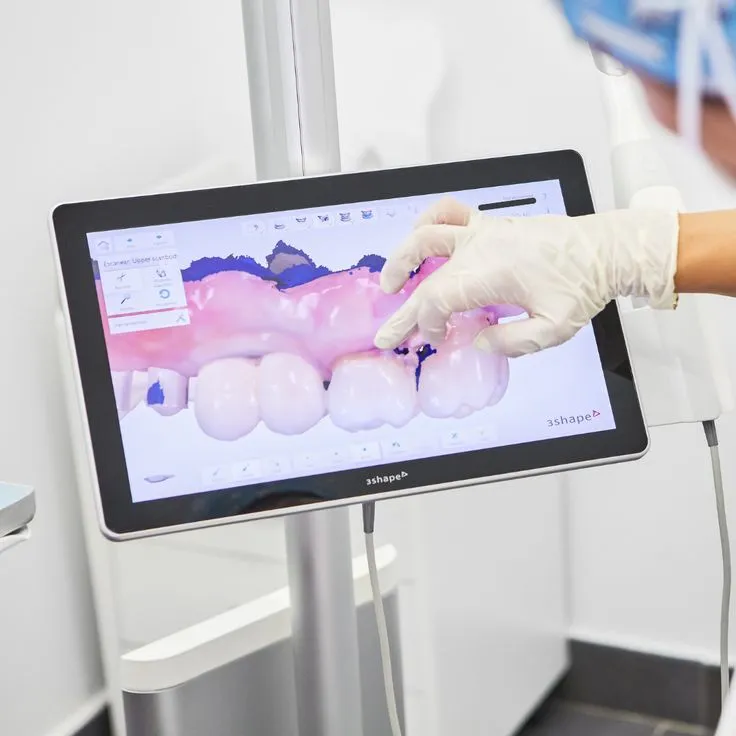 _En-la-clínica-dental-Ruiz-de-Gopegui-apostamos-por-la-mejor-tecnología-para-estudiar-en-detalle-t